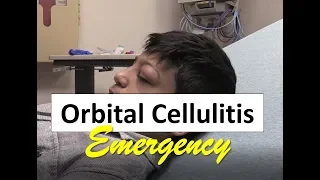 Orbital Cellulitis Emergency in a Child