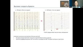 Электроэнцефалография: основные биофизические и технологические аспекты для использования в клинике