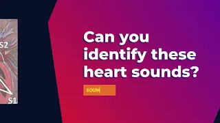 Can You Identify These Heart Sounds?