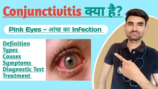 Conjunctivitis in Hindi | Causes, Symptoms and Treatment of Conjunctivitis