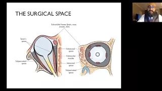 Surgical Management of Orbital Disease