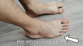 Кажется я сломал ногу! Нужна ваша консультация! Стрим со зрителями!