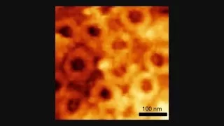 Video imaging by high-speed atomic force microscopy captures a nuclear pore complex at work.