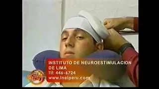 Estimulación Magnética Transcraneal EMT/TMS