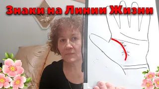 Знаки на линии жизни. Хиромантия