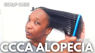 CCCA Alopecia Hair & Scalp Care | Update #alopecia