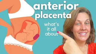 Anterior Placenta Challenges and Risks