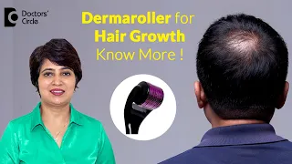 DERMAROLLER FOR HAIR LOSS -How to use for Hair Growth? HAIR REGROWTH -Dr.Rasya Dixit|Doctors' Circle