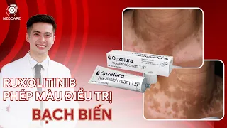 RUXOLITINIB PHÉP MÀU TRONG ĐIỀU TRỊ BẠCH BIẾN