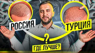 РОССИЯ vs ТУРЦИЯ / ГДЕ ЛУЧШЕ ПЕРЕСАДКА?