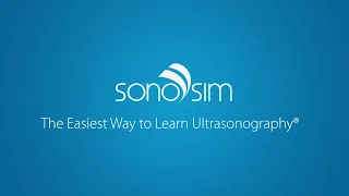 SonoSim Ultrasound Training Solution