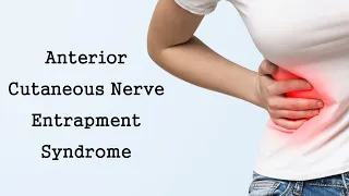 Anterior Cutaneous Nerve Entrapment Syndrome