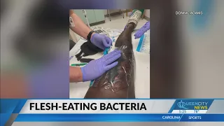 FL man gets flesh-eating bacteria after person bites him