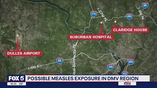 Measles Alert: Montgomery County resident tests positive, potential exposure in DC, Maryland, Virgin