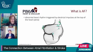 The Connection Between Atrial Fibrillation & Stroke