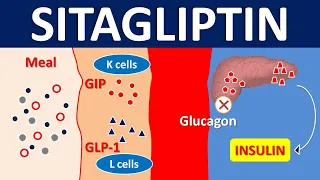 Sitagliptin for type 2 diabetes mellitus | DPP 4 inhibitor | Mechanism, precautions & side effects