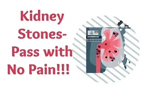 Kidney Stones- Pass Them Without Pain