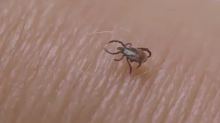 It's tick season in Colorado: Here's what to know