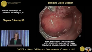 Total Endoscopic Management of Gastro gastric Anastomotic Leaks Following Revisional Bariatric Surge