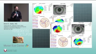 Refractive Surgery (4 of 4)