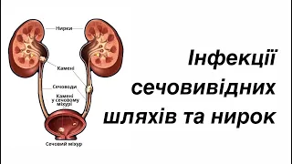 Інфекції сечовивідних шляхів та нирок.