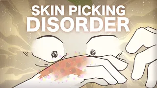 Skin Picking Disorder .. What is it?
