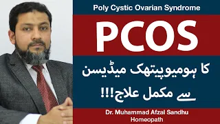 How To Treat PCOS | PCOS Ka Ilaj In Urdu | Homeopathic Medicine | PCOS Treatment