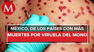México tiene una de las tasas más altas de muertes por viruela del mono: experta