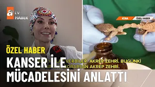 ÖZEL HABER – Tanyeli Küba’dan akrep zehri ilacıyla döndü - atv Ana Haber 2 Kasım 2023