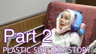 MY PLASTIC SURGERY STORY IN KOREA | Part 2