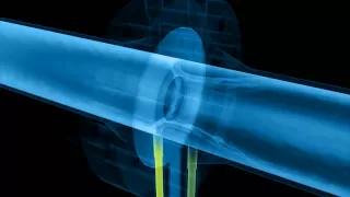 The Differential Pressure Flow Measuring Principle (Orifice-Nozzle-Venturi)