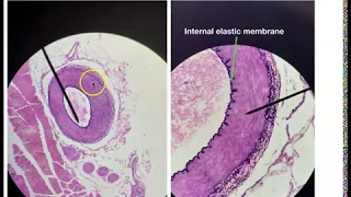 Blood vessel Histology