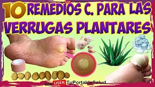 Como Eliminar las VERRUGAS PLANTARES  con estos 10 Remedios Caseros