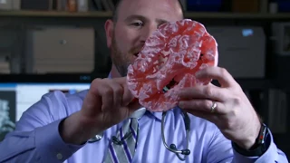 3D Printing at Baystate Medical Center