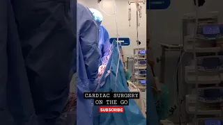 Cardiac surgery on the Go #anesthesia #ot#surgery #cardiac