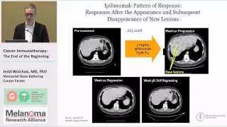 Cancer Immunotherapy: The End of the Beginning