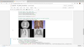 Medical image processing in your web browser using Jupyter notebooks and 3D Slicer