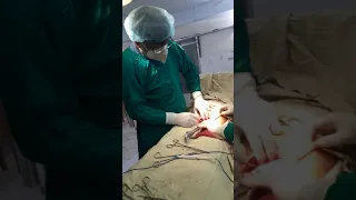 cesarean Delivery || Touch Surgery