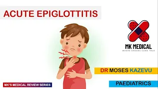 Acute Epiglottitis