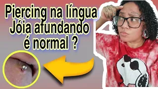 Piercing na língua - a jóia afundou é normal ?