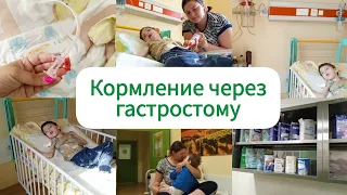 Операция 🥺 и три недели в больнице 🙄/ Кормление через ГАСТРОСТОМУ балонную 👌Москва НЦЗД👌