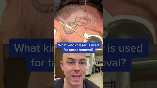 Doctor reacts to funny tattoo removal! #laser #tattoo #dermreacts