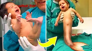 10 Most Unique Babies Ever Born