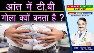 आंत में टी बी गोला क्यों बनता है ? || ABDOMINAL TB GASTRO INTESTINAL TB