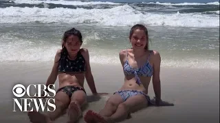12-year-old contracts flesh-eating bacteria during Florida vacation
