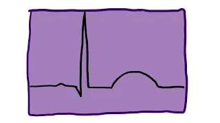 Po mojemu: EKG cz. 6