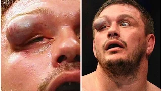 Top 10 Worst Injuries in UFC History [18+] - Scariest MMA Fight Injuries & Knockouts