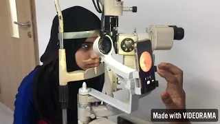 Fundus Camera ( MII Ret Cam ) @ Rs 23,999 ( India) and USD 380/ ( International)