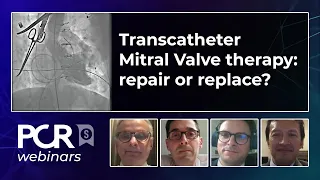 Transcatheter Mitral Valve therapy : repair or replace? - Webinar