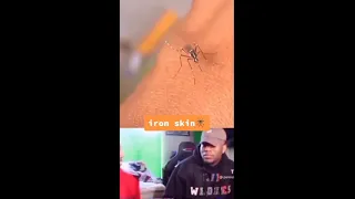 noob mosquito bite 😂 funny video